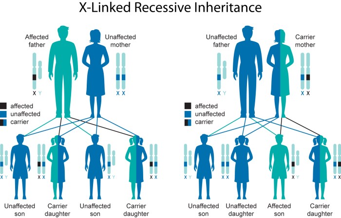 Linked recessive inheritance disorders gene mother congenital chromosome disease carrier mutation sex disorder affected nystagmus eyes blindness syndrome genetic genes